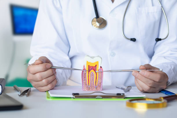 Best Knocked-Out Tooth (Avulsed Tooth) Treatment in Buena Park, CA