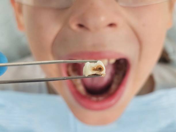 Best Walk-In Emergency Dental Services in Buena Park, CA